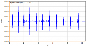 MVC plots versus the corresponding raw EMG signals