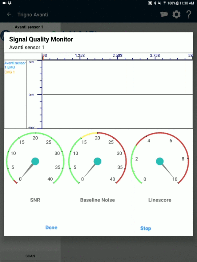 Preview of Signal Quality Monitor in EMG Plots