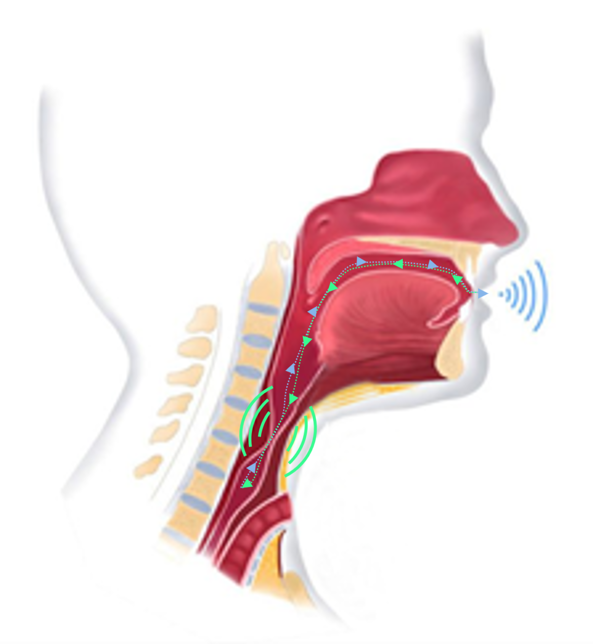 EMG Voice; How electromyography is giving a voice to those who cannot ...